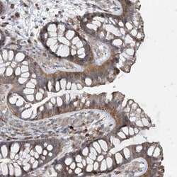 N4BP2 Antibody, Novus Biologicals:Antibodies:Primary Antibodies
