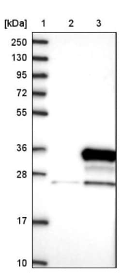 N4BP2L1 Antibody, Novus Biologicals 0.1mL; Unlabeled:Antibodies, Polyclonal