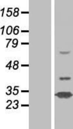 Novus Biologicals&trade;&nbsp;N4BP2L1 Overexpression Lysate