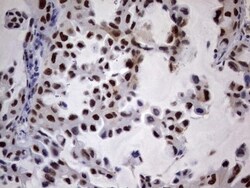 N4BP2L2 Antibody (OTI1C8), Novus Biologicals 0.1mL; Unlabeled:Antibodies,
