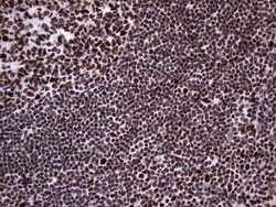 N4BP2L2 Antibody (OTI1C8), Novus Biologicals 0.1mL; Unlabeled:Antibodies,