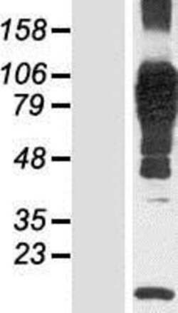 Novus Biologicals&trade;&nbsp;N4BP3 Overexpression Lysate