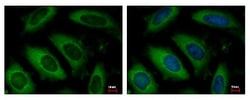 NAA10 Antibody, Novus Biologicals 0.1mL; Unlabeled:Antibodies, Polyclonal