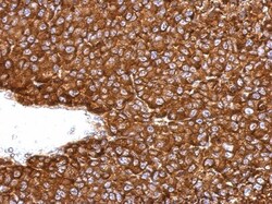 NAA10 Antibody, Novus Biologicals 0.1mL; Unlabeled:Antibodies, Polyclonal