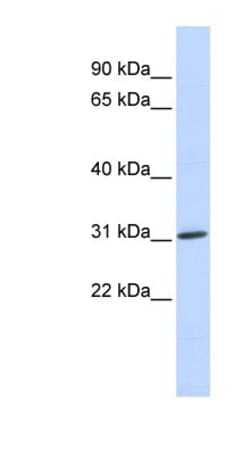 NAA10 Antibody, Novus Biologicals 100&mu;L; Unlabeled:Antibodies, Polyclonal