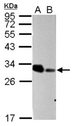 NAA10 Antibody, Novus Biologicals 0.1mL; Unlabeled:Antibodies, Polyclonal