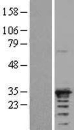 Novus Biologicals&trade;&nbsp;NAA10 Overexpression Lysate