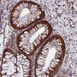 NAA10 Antibody, Novus Biologicals 0.1mL; Unlabeled:Antibodies, Polyclonal