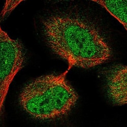 NAA11 Antibody, Novus Biologicals 0.1mL; Unlabeled:Antibodies, Polyclonal