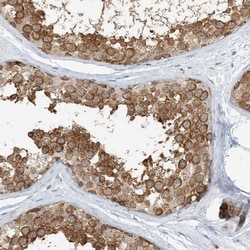 NAA11 Antibody, Novus Biologicals 0.1mL; Unlabeled:Antibodies, Polyclonal