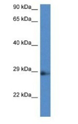 NAA11 Antibody, Novus Biologicals 100&mu;L; Unlabeled:Antibodies, Polyclonal