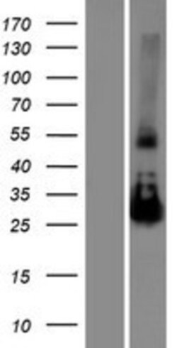 Novus Biologicals&trade;&nbsp;NAA11 Overexpression Lysate