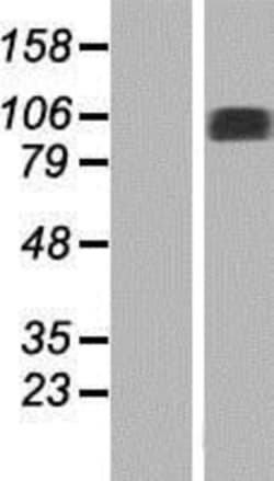 Novus Biologicals&trade;&nbsp;NAA25 Overexpression Lysate