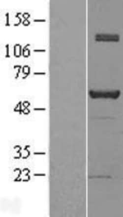 Novus Biologicals&trade;&nbsp;NAB1 Overexpression Lysate