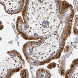 Nab2 Antibody, Novus Biologicals:Antibodies:Primary Antibodies