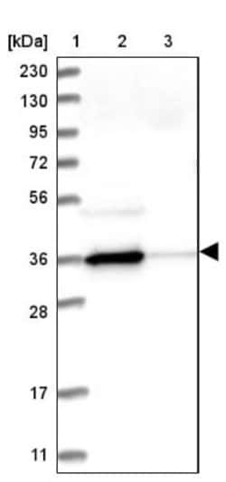 N-Acetyl-D-Glucosamine Kinase/NAGK Antibody, Novus Biologicals:Antibodies:Primary