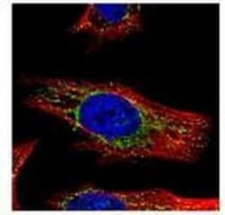 N-Acetylgalactosamine-6-Sulfatase/GALNS Antibody, Novus Biologicals 0.1mg;