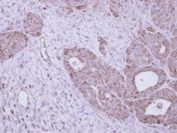 N-Acetylgalactosamine-6-Sulfatase/GALNS Antibody, Novus Biologicals 0.1mg;