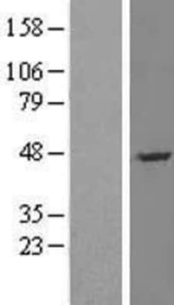 Novus Biologicals&trade;&nbsp;NGFRAP1/BEX3/NADE Overexpression Lysate