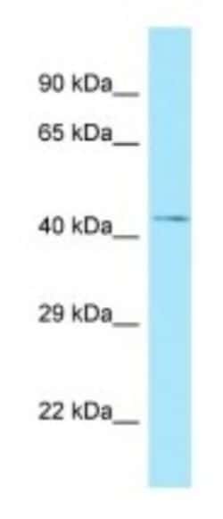 NADK Antibody, Novus Biologicals 20&mu;L; Unlabeled:Antibodies, Polyclonal