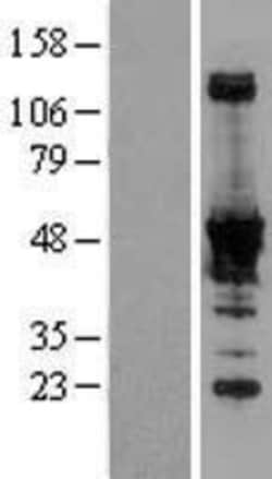 Novus Biologicals&trade;&nbsp;NADK Overexpression Lysate