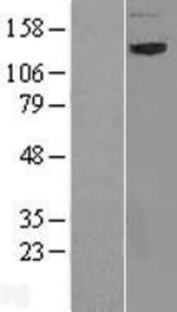 Novus Biologicals&trade;&nbsp;NAG Overexpression Lysate