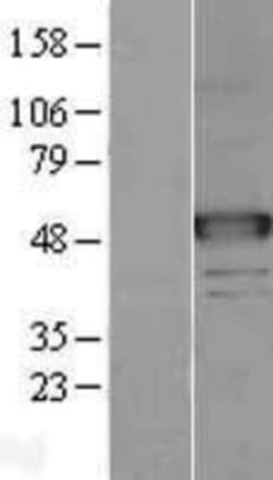 Novus Biologicals&trade;&nbsp;alpha-N-acetylgalactosaminidase/NAGA Overexpression Lysate