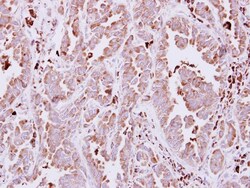 alpha-N-acetylglucosaminidase/NAGLU Antibody, Novus Biologicals 0.1mL;