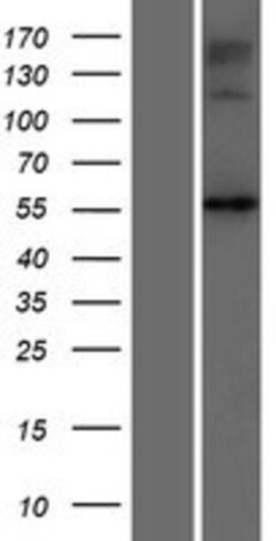 Novus Biologicals&trade;&nbsp;NAGS Overexpression Lysate