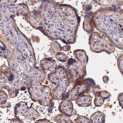NAIP Antibody, Novus Biologicals 0.1mL; Unlabeled:Antibodies, Polyclonal