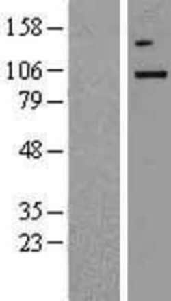 Novus Biologicals&trade;&nbsp;TBK1 Overexpression Lysate