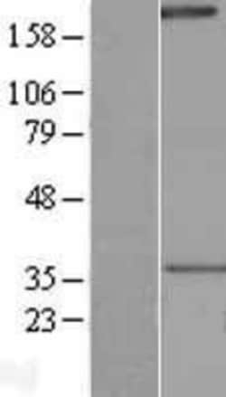 Novus Biologicals&trade;&nbsp;NLRP1/NALP1 Overexpression Lysate