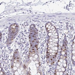 NALP8 Antibody, Novus Biologicals 0.1mL; Unlabeled:Antibodies, Polyclonal