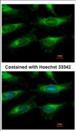 anti-PBEF/Visfatin/NAMPT, Polyclonal, Novus Biologicals 0.1 mL | Buy Online | Novus Biologicals | Fisher Scientific