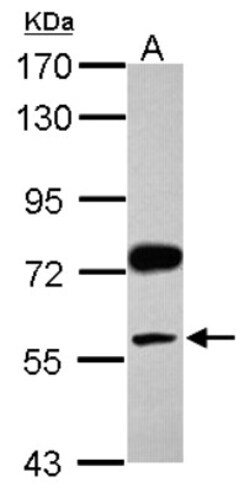 anti-PBEF/Visfatin/NAMPT, Polyclonal, Novus Biologicals 0.1 mL | Buy Online | Novus Biologicals | Fisher Scientific