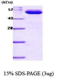 Novus Biologicals&trade;&nbsp;Recombinant Mouse PBEF/Visfatin/NAMPT His Protein