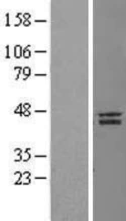 Novus Biologicals&trade;&nbsp;Nanog Overexpression Lysate