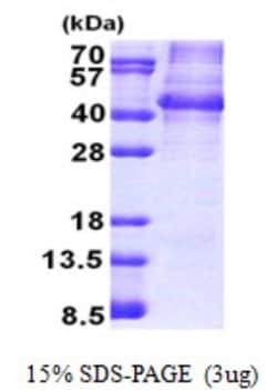 Novus Biologicals&trade;&nbsp;Recombinant Human NANOGP8 His Protein