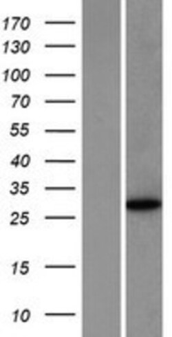Novus Biologicals&trade;&nbsp;NANOS1 Overexpression Lysate