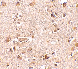 Nanos2 Antibody - BSA Free, Novus Biologicals 0.1mg; Unlabeled:Antibodies,