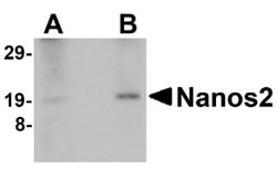 Nanos2 Antibody - BSA Free, Novus Biologicals 0.025 mg, Unconjugated:Antibodies,