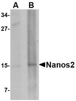 Nanos2 Antibody - BSA Free, Novus Biologicals 0.1mg; Unlabeled:Antibodies,