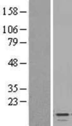 Novus Biologicals&trade;&nbsp;CXCL7/NAP-2 Overexpression Lysate