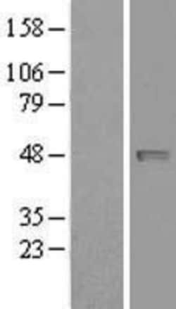 Novus Biologicals&trade;&nbsp;NAPE-PLD Overexpression Lysate