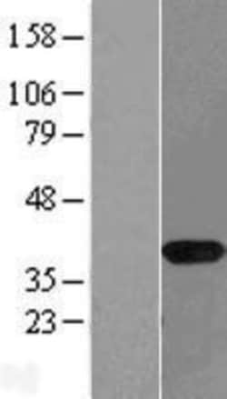Novus Biologicals&trade;&nbsp;NAPG Overexpression Lysate