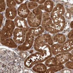 NAPRT1 Antibody, Novus Biologicals 25 &mu;L; Unlabeled:Antibodies, Polyclonal