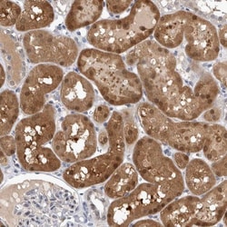NAPRT1 Antibody, Novus Biologicals:Antibodies:Primary Antibodies