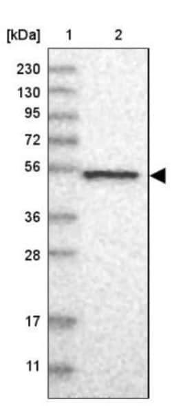 NAPRT1 Antibody, Novus Biologicals:Antibodies:Primary Antibodies
