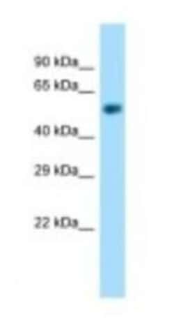 NAPRT1 Antibody, Novus Biologicals 100 &mu;L | Buy Online | Novus Biologicals | Fisher Scientific