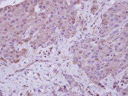 NARG1 Antibody, Novus Biologicals 0.1mL; Unlabeled:Antibodies, Polyclonal